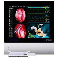 Operating Room Integration System - Digital Negatoscope & Telemedicine System